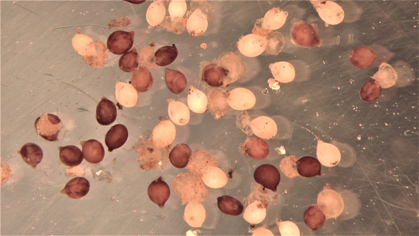 SCN Cysts_mgm SCN