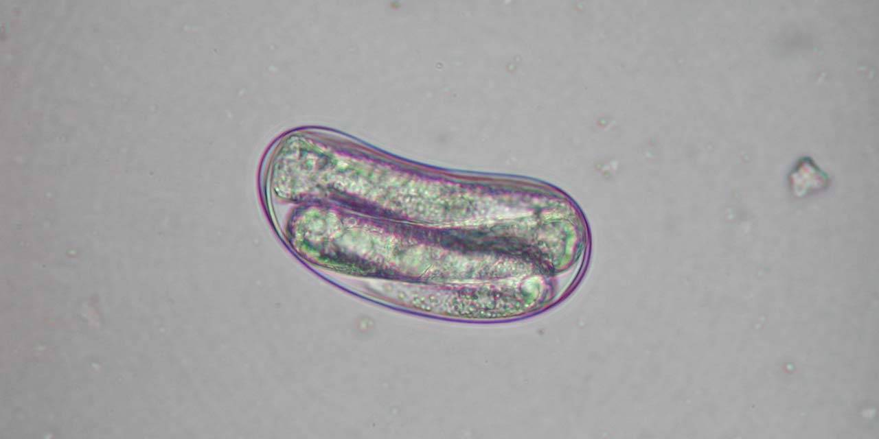 Closeup microscope photo of Reniform Nematode