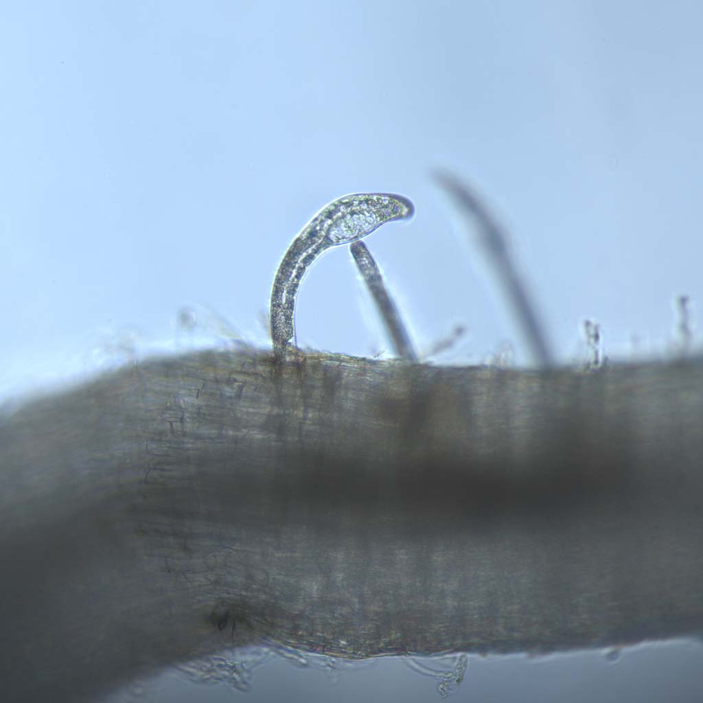 Closeup microscope photo of Reniform Nematode