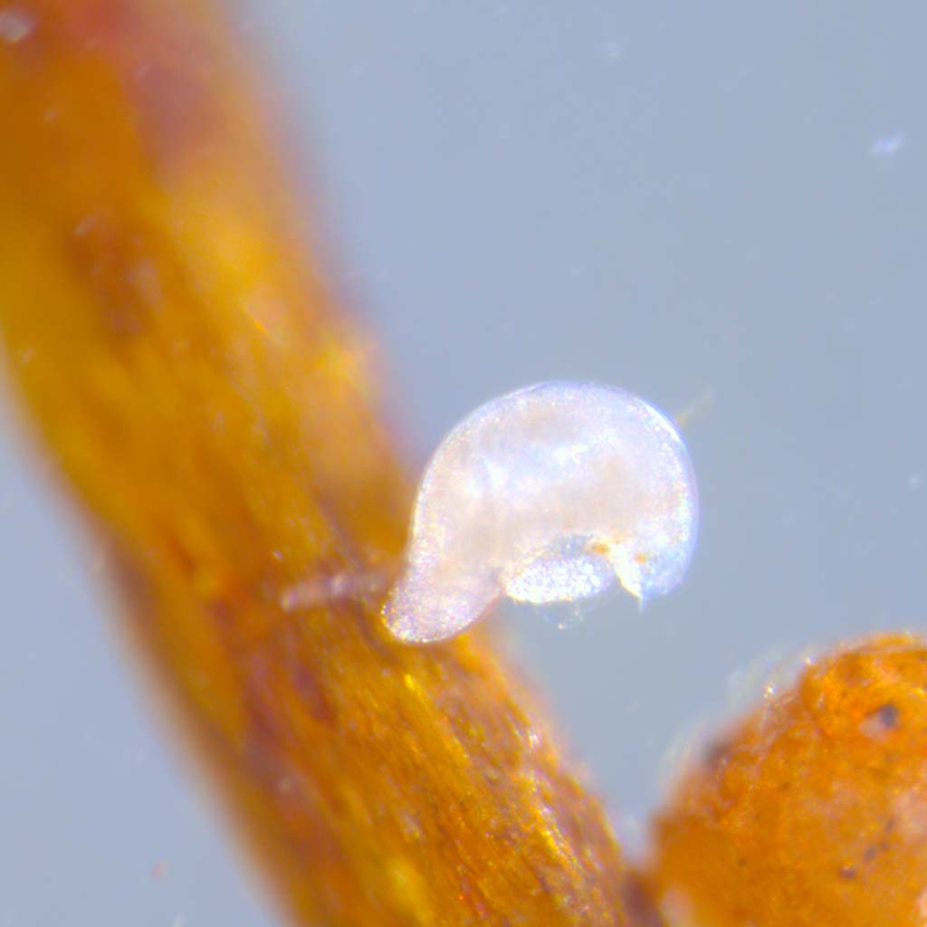 Closeup microscope photo of Reniform Nematode