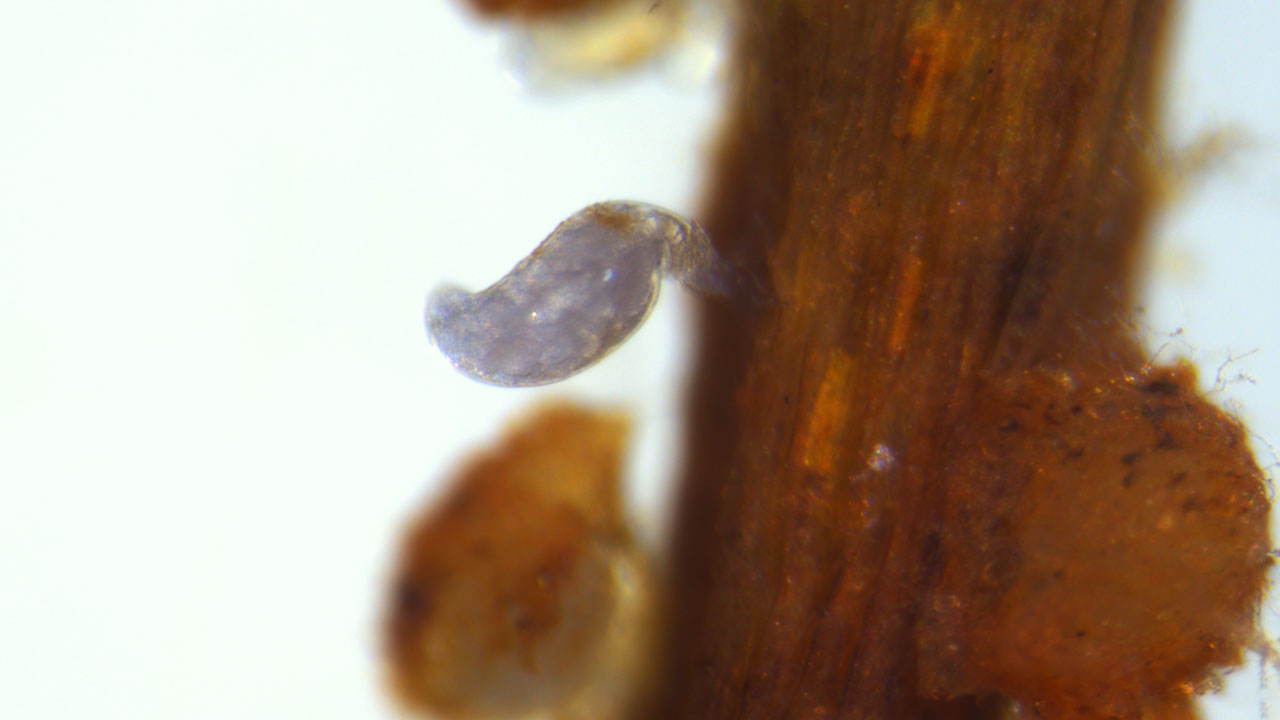 Closeup microscope photo of Reniform Nematode