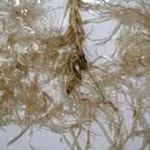 Closeup microscope photo of Root Lesion Nematode