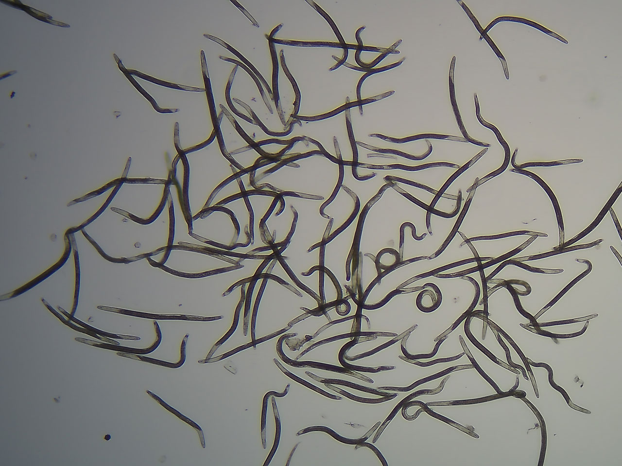 Closeup microscope photo of Root Lesion Nematode