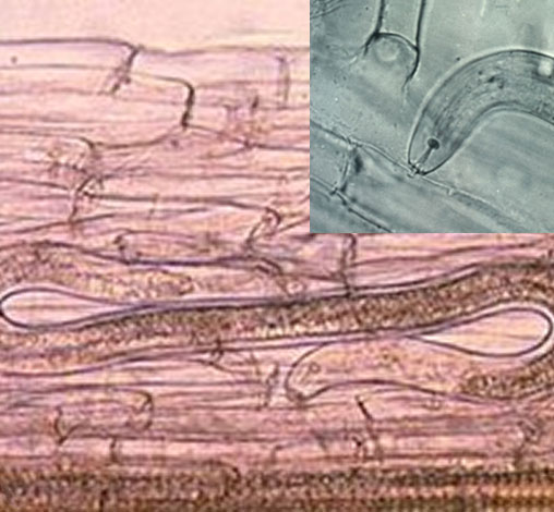 Multiple microscope photos of Root Lesion Nematode